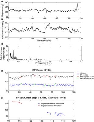 Post-ictal Modulation of Baroreflex Sensitivity in Patients With Intractable Epilepsy